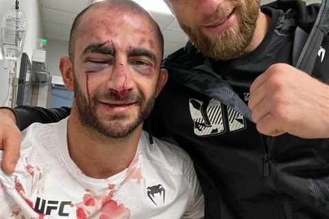 UFC star Giga Chikadze shows off gruesome bloodied face and horrific post-fight injuries after..