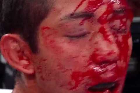 Bermudez left a bloodied mess after being battered before eighth round KO to Japanese star Kyoguchi ..