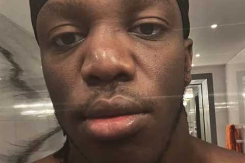 KSI shows off gruesome broken nose but British YouTube star still set to fight Alex Wassabi in..