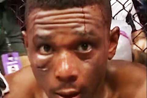 ‘That’s creepy’ – UFC fans in shock with gruesome amount of blood pouring off Jamahal Hill’s head..