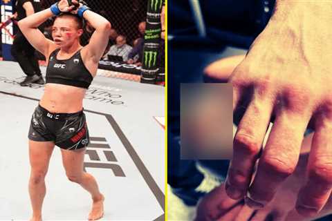 Rose Namajunas shows off gruesome injury she suffered in flyweight debut defeat at UFC Paris