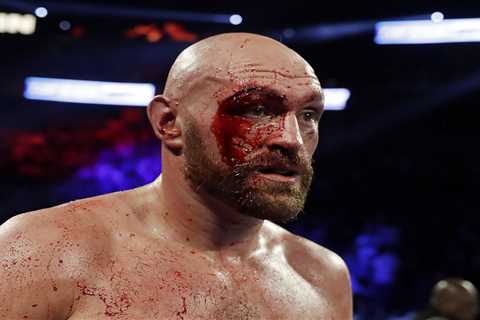 Tyson Fury Sends Money to Hero Cutman Who Saved His Career During Wallin Fight